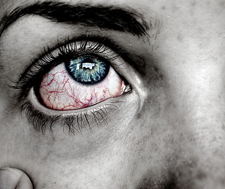 Augengrippe: Das macht sie so gefährlich