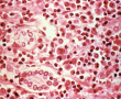Covid-19: Auch Zellen des Mundraums betroffen