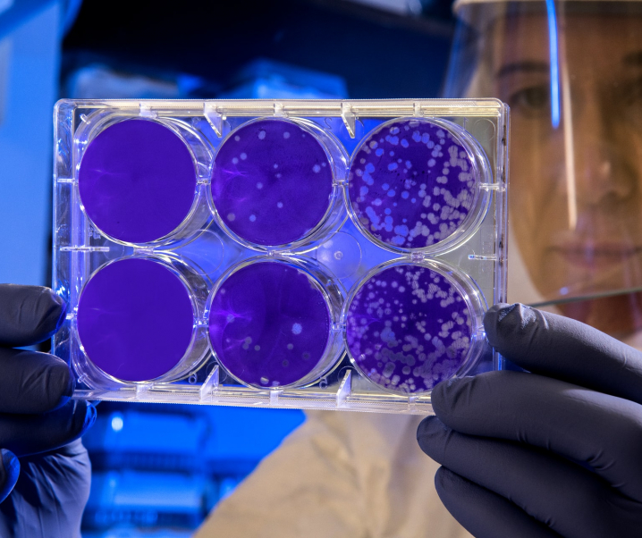 Durchbruch in der Forschung: Dieser Stoff hemmt resistente Tumorzellen