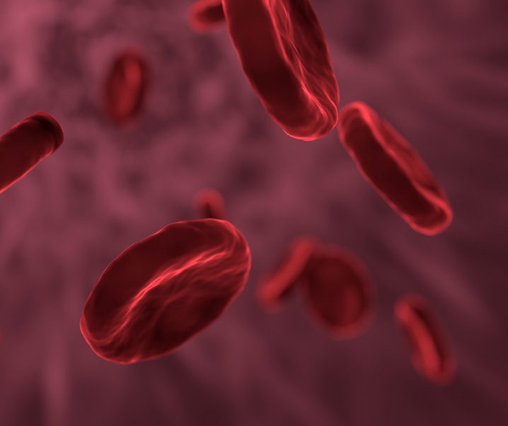 Hirnblutungen verursacht durch Blutverdünner?