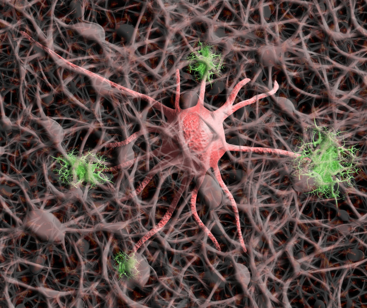 Sabotage im Nervensystem: Wie Neuronen die eigene Heilung verhindern