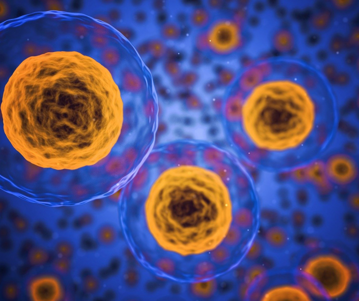 Erfolg bei Lupus-Therapie: CAR-T-Zellen bringen neue Hoffnung bei Autoimmunerkrankungen