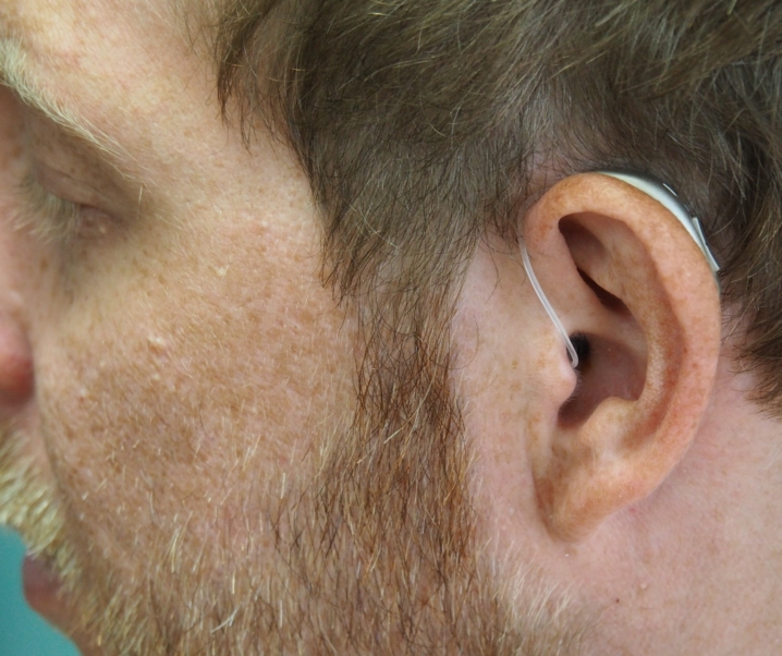 Hörverlust: Wieso Menschen schwerhörig werden und was man dagegen tun kann