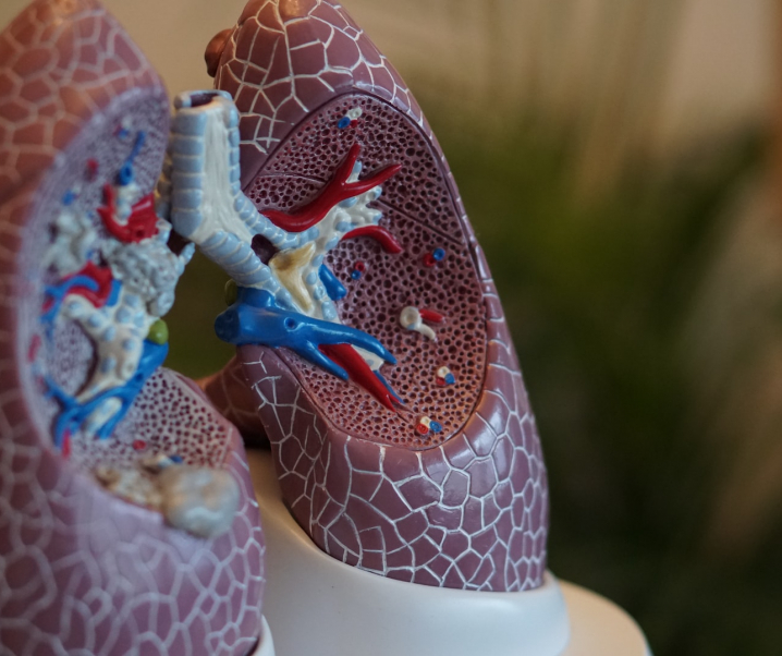 Atemlosigkeit: Was bei einem Asthmaanfall in der Lunge geschieht