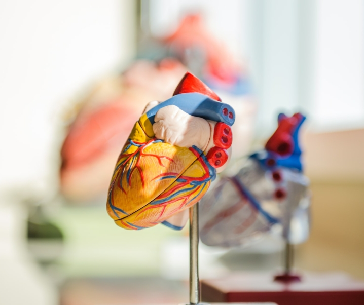 Die Spritze gegen Herzinfarkte: Ist Inclisiran die Lösung bei Herzproblemen?