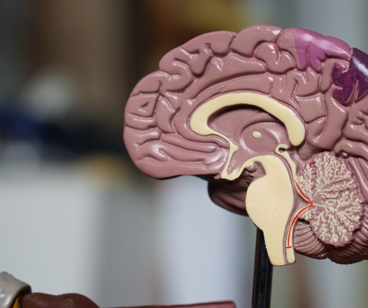 Hirnschrittmacher: Neueste Forschung liefert Hoffnung für Therapie der Alzheimer-Demenz