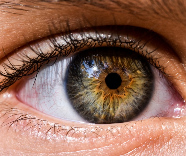 Retinaler Venenverschluss: Schlaganfall im Auge kann zur Erblindung führen