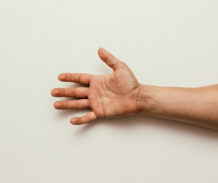 Alien-Hand-Syndrom: Wenn man keine Kontrolle mehr über die eigene Hand hat