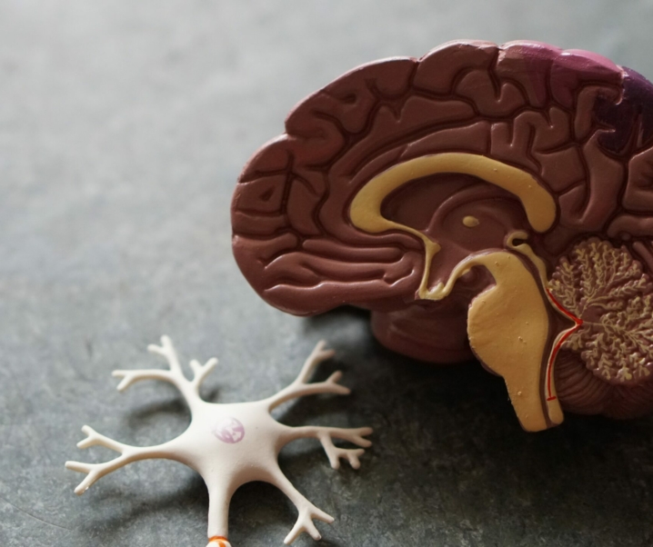Alzheimer: Innovatives Molekül könnte Behandlung revolutionieren