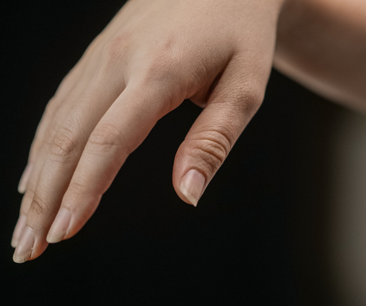 Probleme mit den Fingernägeln? Diese ernsten Krankheiten könnten dahinterstecken