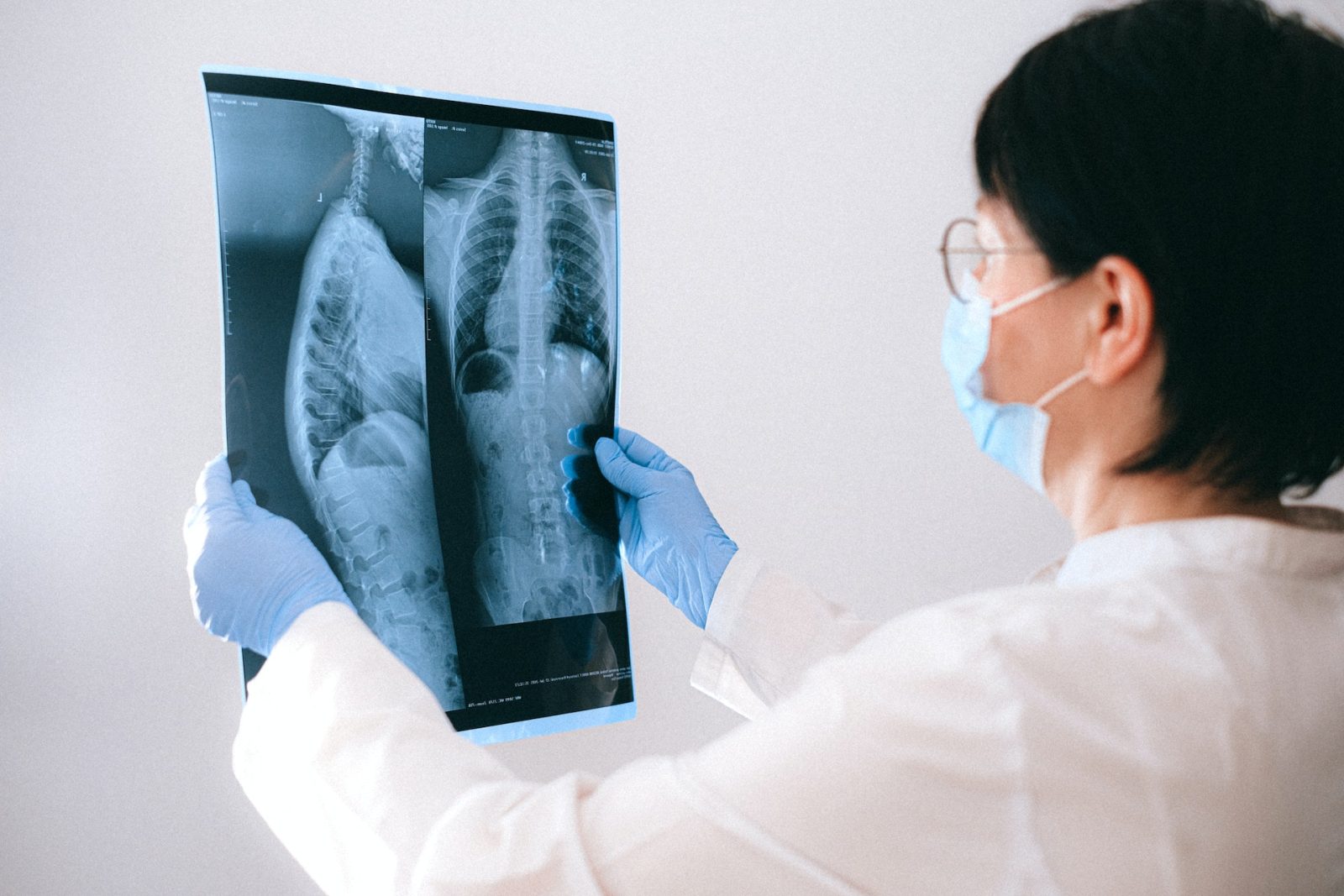 Ärztin begutachtet Röntgenaufnahme einer Lunge