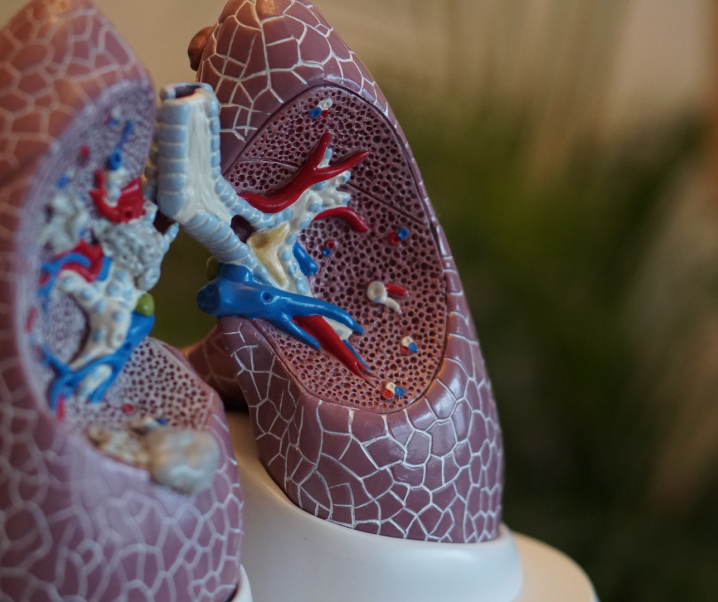 Ständige Atemnot: So gefährlich ist die Lungenfibrose